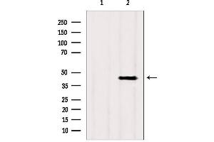 Western blot analysis of extracts from rat heart, using ACADS antibody. (ACADS 抗体)