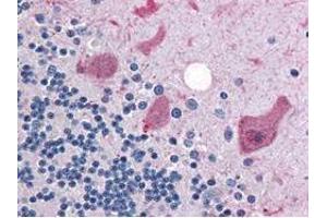Immunohistochemistry (IHC) image for anti-Cyclin antibody (ABIN964620)