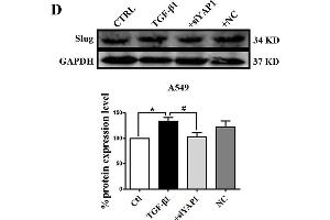 Slug is regulated by the co-transcriptional complex YAP1/TEAD in the EMT program of A549 cells. (GAPDH 抗体)