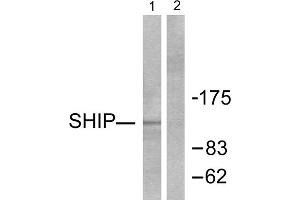 Western blot analysis of extracts from Jurkat cells, treated with PMA (1ng/ml, 15mins), using SHIP antibody (ABIN5976503). (INPP5D 抗体  (C-Term))