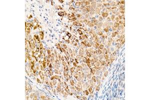 Immunohistochemistry of paraffin-embedded rat ovary using OGDH Rabbit pAb (ABIN6131414, ABIN6145003, ABIN6145005 and ABIN6222018) at dilution of 1:25 (40x lens). (alpha KGDHC 抗体  (AA 148-427))