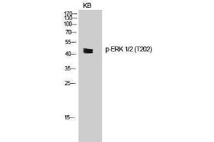 Western Blotting (WB) image for anti-Mitogen-Activated Protein Kinase 1/3 (MAPK1/3) (pThr202) antibody (ABIN3172890) (ERK1/2 抗体  (pThr202))