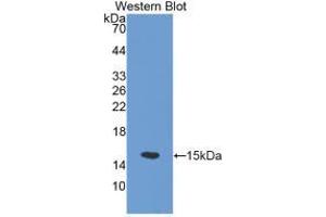 Western blot analysis of the recombinant protein. (SLC30A5 抗体  (AA 639-751))