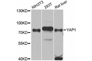 Western blot analysis of extracts of various cell lines, using YAP1 antibody (ABIN5974703) at 1/1000 dilution. (YAP1 抗体)