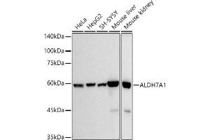 Western blot analysis of extracts of various cell lines, using  antibody (ABIN7265544) at 1:500 dilution. (ALDH7A1 抗体)
