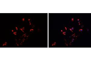ABIN6279542 staining HEPG2 cells by IF/ICC. (IMMP2L 抗体  (Internal Region))