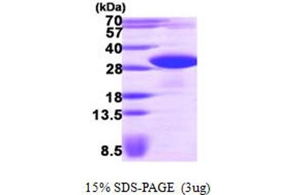 VAPB Protein (AA 1-222) (His tag)