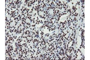 Immunohistochemical staining of paraffin-embedded Human breast tissue using anti-NONO mouse monoclonal antibody. (NONO 抗体  (AA 184-385))