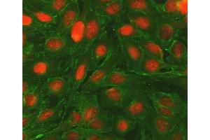 IF analysis of BCL2 and Tubulin alpha using anti-BCL2 antibody (ABIN5693065) and anti-Tubulin alpha antibody (ABIN7600339).