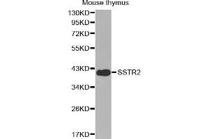 Western Blotting (WB) image for anti-Somatostatin Receptor 2 (SSTR2) (C-Term) antibody (ABIN3017443)