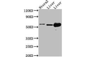 Western Blot Positive WB detected in: Ntera-2 whole cell lysate, Mouse Liver whole cell lysate, Rat Liver cell lysate All lanes: ALDH2 antibody at 1:1000 Secondary Goat polyclonal to rabbit IgG at 1/50000 dilution Predicted band size: 57, 51 kDa Observed band size: 57 kDa (Recombinant ALDH2 抗体)