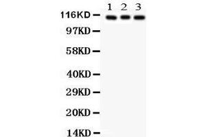 Anti- ATP1A1 Picoband antibody, Western blotting All lanes: Anti ATP1A1  at 0. (ATP1A1 抗体  (N-Term))