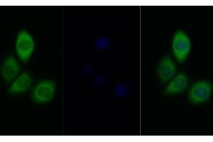 Detection of INSR in Human MCF7 cell using Polyclonal Antibody to Insulin Receptor (INSR) (Insulin Receptor 抗体  (AA 1101-1372))