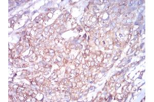 Immunohistochemistry (IHC) image for anti-Tubulin, beta 1 (TUBB1) (AA 33-166) antibody (ABIN5542398)