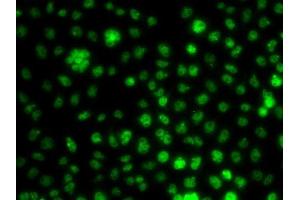 Immunofluorescence analysis of A549 cells using UBE2R2 antibody.