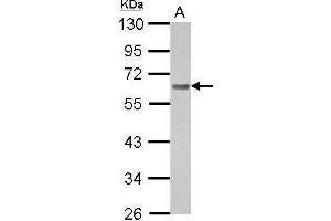 WB Image Sample (30 ug of whole cell lysate) A: A431 10% SDS PAGE antibody diluted at 1:1000 (BIN1 抗体)
