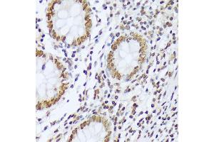 Immunohistochemistry of paraffin-embedded human appendix using Phospho-c-Abl-Y412 antibody (ABIN7265966) at dilution of 1:100 (40x lens). (ABL1 抗体  (pTyr412))