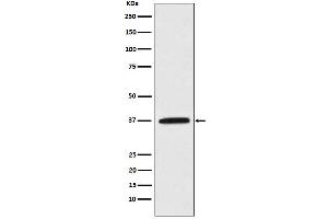 Western blot analysis of Kallikrein 5 expression in MCF-7 cell lysate.