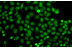 Immunofluorescence (IF) image for anti-Phosphatidylinositol-4-Phosphate 5-Kinase, Type I, alpha (PIP5K1A) antibody (ABIN7008201)