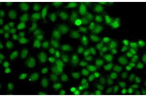 Immunofluorescence analysis of A549 cells using PIP5K1A Polyclonal Antibody (PIP5K1A 抗体)