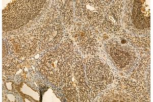 ABIN6264546 and ABIN6272948 at 1/100 staining Rat ovary tissue by IHC-P. (QSOX1 抗体  (Internal Region))