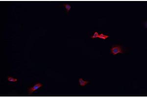 ABIN6268970 staining HeLa? (Dematin 抗体  (pSer403))