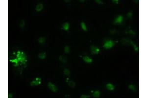 Immunofluorescence (IF) image for anti-alpha-Fetoprotein (AFP) (AA 19-397) antibody (ABIN2716008)