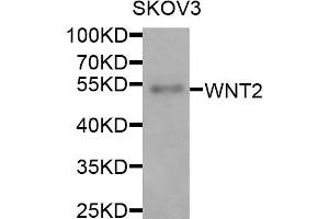 Western blot analysis of extracts of SKOV3 cells, using WNT2 antibody. (WNT2 抗体)