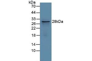Detection of Recombinant GCLM, Human using Polyclonal Antibody to Glutamate Cysteine Ligase, Modifier Subunit (GCLM) (GCLM 抗体  (AA 40-251))