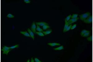 Detection of CYCS in Human MCF7 cell using Polyclonal Antibody to Cytochrome C (CYCS) (Cytochrome C 抗体  (AA 5-100))