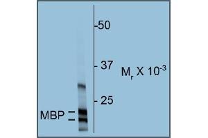 Western blot of rat cortex homogenate showing specific immunolabeling of the ~18 & 22k MBP protein. (MBP 抗体)