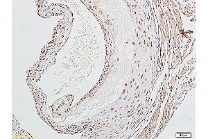 Formalin-fixed and paraffin embedded rat aorta labeled with Anti-LOX-1 Polyclonal Antibody, Unconjugated (ABIN676988) followed by conjugation to the secondary antibody and DAB staining (OLR1 抗体  (AA 201-273))