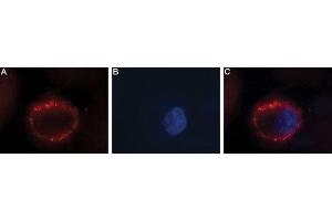Expression of FSH receptor in human ovary cell line - Cell surface detection of FSH receptor in intact living human OVCAR3 cells. (FSHR 抗体  (Extracellular))