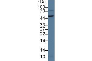 Detection of vWA1 in Rat Testis lysate using Polyclonal Antibody to Von Willebrand Factor A Domain Containing Protein 1 (vWA1) (VWA1 抗体  (AA 42-289))