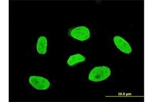 Immunofluorescence of monoclonal antibody to TBX3 on HeLa cell. (TBX3 抗体  (AA 311-410))