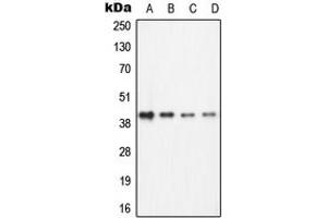 Western blot analysis of ECA39 expression in Jurkat (A), Ramos (B), NIH3T3 (C), PC12 (D) whole cell lysates.