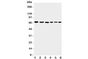 Western blot testing of Apoptosis-Inducing Factor antibody and Lane 1:  rat heart (AIF 抗体  (C-Term))