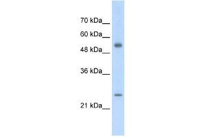 AK3L1 antibody used at 2. (AK4 抗体  (Middle Region))