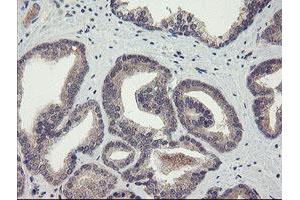 Image no. 7 for anti-rho GTPase Activating Protein 2 (ARHGAP2) antibody (ABIN1499627)