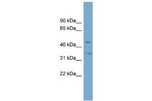 Western Blotting (WB) image for anti-Solute Carrier Family 39 (Zinc Transporter), Member 8 (SLC39A8) (N-Term) antibody (ABIN2781682)