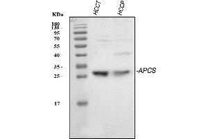 Western blot analysis of Serum Amyloid P/APCS using anti-Serum Amyloid P/APCS antibody (ABIN5693182). (APCS 抗体  (AA 20-220))