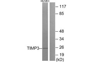 Western blot analysis of extracts from HUVEC cells, using TIMP3 antibody. (TIMP3 抗体  (Internal Region))