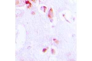 Immunohistochemical analysis of ARRDC3 staining in human brain formalin fixed paraffin embedded tissue section. (ARRDC3 抗体  (C-Term))