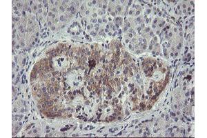 Immunohistochemical staining of paraffin-embedded Human pancreas tissue using anti-EIF5A2 mouse monoclonal antibody. (EIF5A2 抗体)