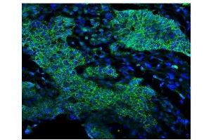 IF analysis of EGFR using anti-EGFR antibody (ABIN7601478). (EGFR 抗体  (AA 36-497))