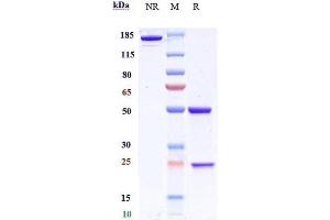 Anti-BACE1 Reference Antibody (Genentech anti-BACE1) on SDS-PAGE under reducing (R) condition.