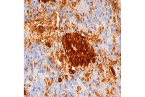 Staining of paraffin embedded human pancreas with mouse anti rat Insulin. (Insulin 抗体)