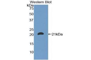 Western blot analysis of the recombinant protein. (CD8B 抗体  (AA 22-170))