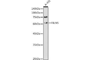 Western blot analysis of extracts of A-431 cells, using FBLN5 antibody (ABIN6127927, ABIN6140497, ABIN6140498 and ABIN6225300) at 1:1000 dilution. (Fibulin 5 抗体  (AA 199-448))
