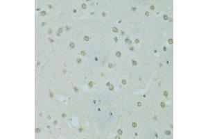 Immunohistochemistry (Paraffin-embedded Sections) (IHC (p)) image for anti-Scaffold Attachment Factor B (SAFB) (AA 1-200) antibody (ABIN6147357)